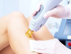 医療レーザー脱毛 痛い/いくら/副反応/効果　